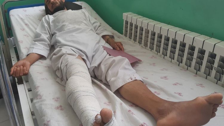 ایک زخمی افغان  رضاکار
