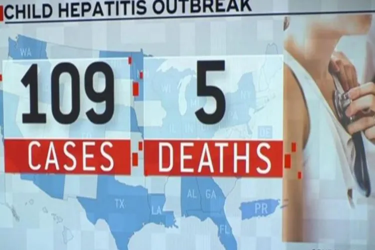امریکہ،:ہیپاٹائٹس کا پھیلاؤ: پانچ بچوں کی موت 