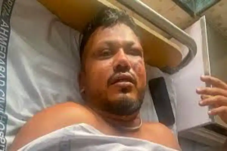 طیارہ حادثہ: وشواس کو وشواس نہیں ہورہا کہ وہ زندہ بچ گیا ہے