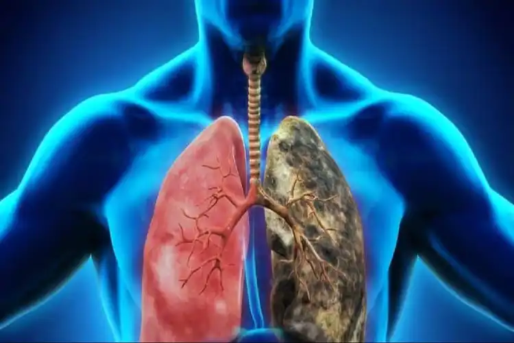 ہندوستان میں کتنے لوگ پھیپھڑے کی بیماری میں مبتلا؟ رپورٹ