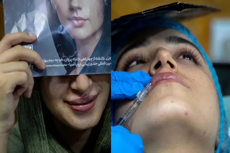 طالبان میں پلاسٹک سرجری کا کریز